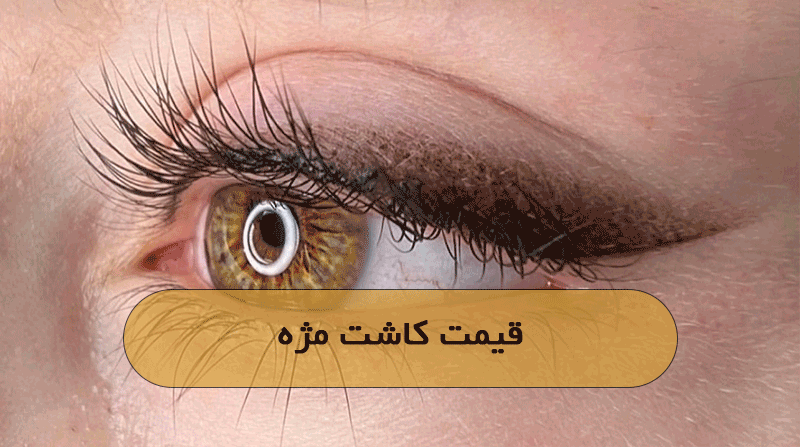 قیمت کاشت مژه