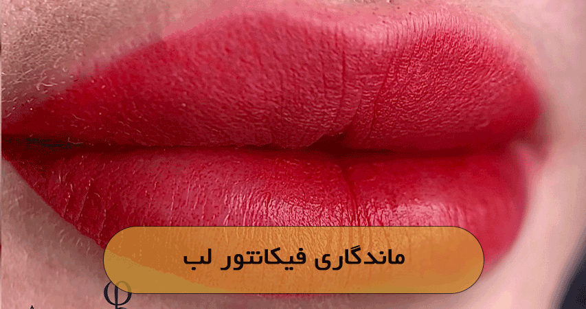 ماندگاری فیکانتور لب