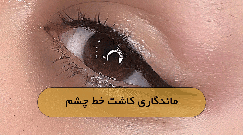 ماندگاری کاشت خط چشم