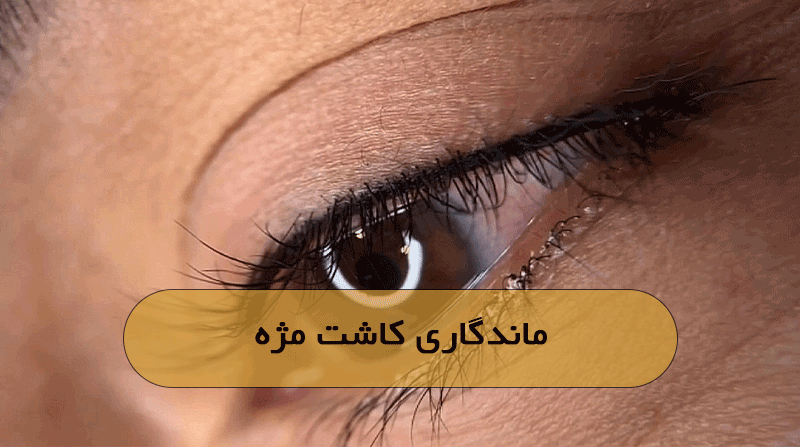 ماندگاری کاشت مژه