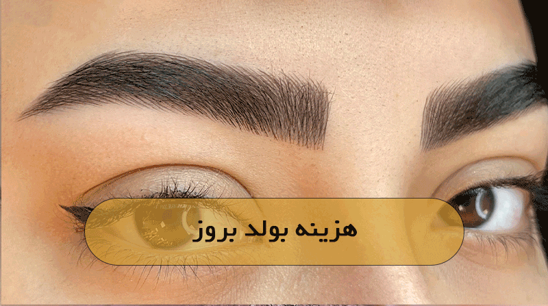 هزینه بولد بروز