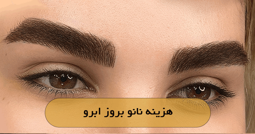 هزینه نانو بروز ابرو