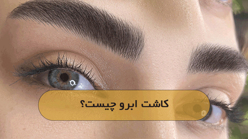 کاشت ابرو چیست؟