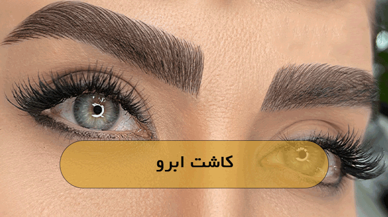 کاشت ابرو
