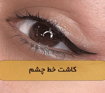 کاشت خط چشم