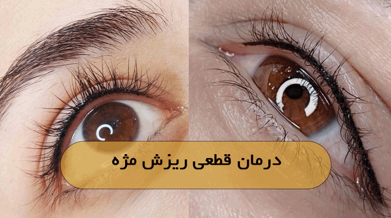 درمان قطعی ریزش مژه