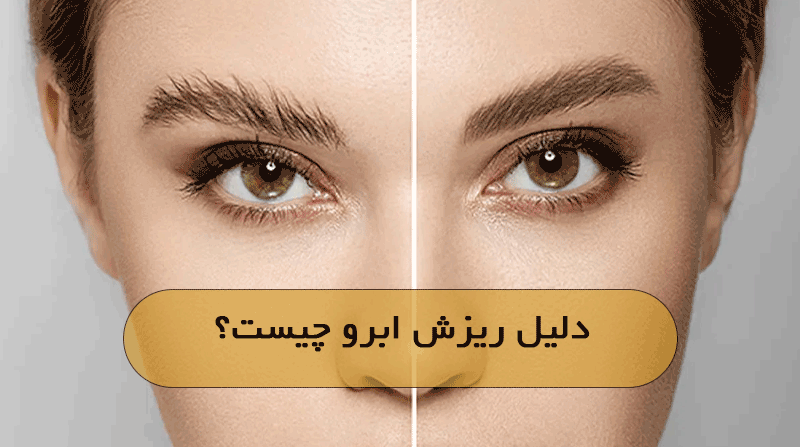 دلیل ریزش ابرو چیست؟