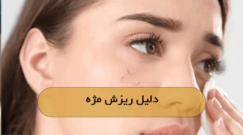 دلیل ریزش مژه