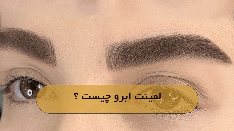 لمینت ابرو چیست ؟