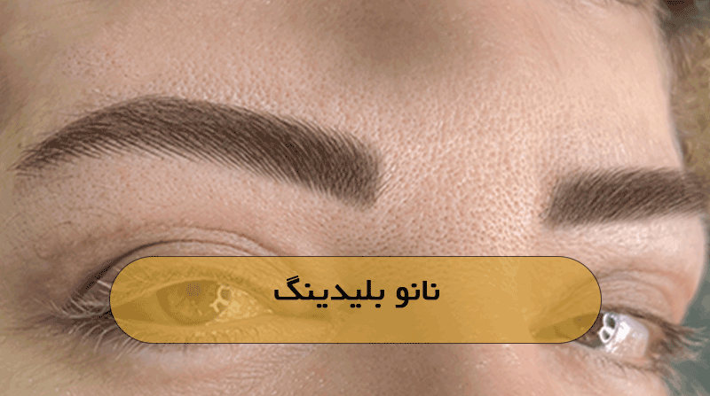 نانو بلیدینگ