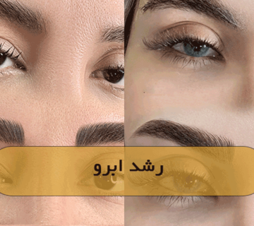 رشد ابرو
