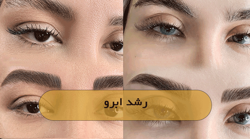 رشد ابرو