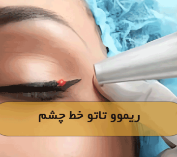 ریموو تاتو خط چشم