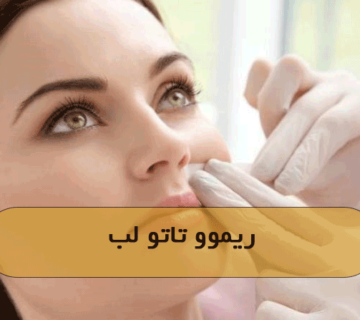 ریموو تاتو لب