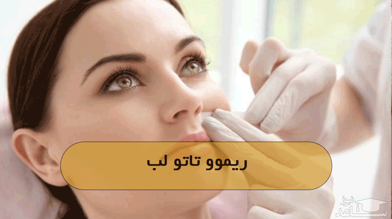 ریموو تاتو لب