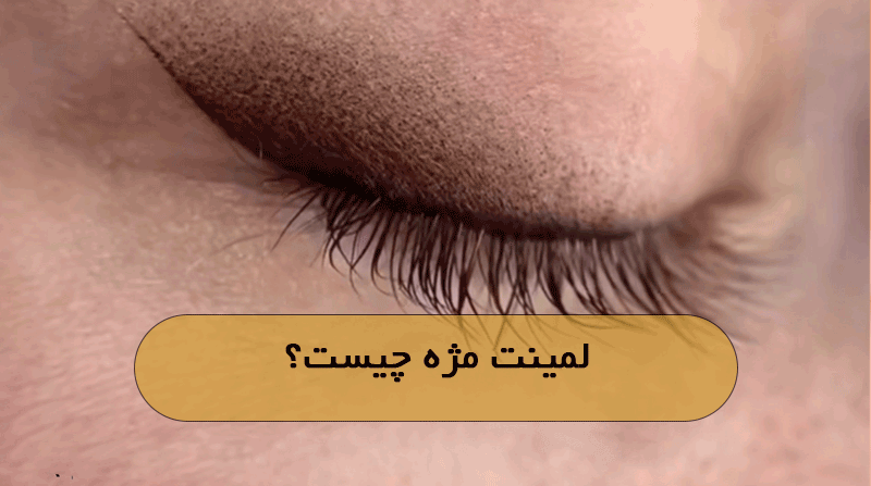 لمینت مژه چیست؟
