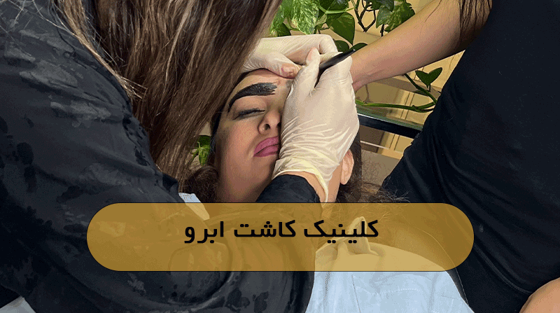 کلینیک کاشت ابرو