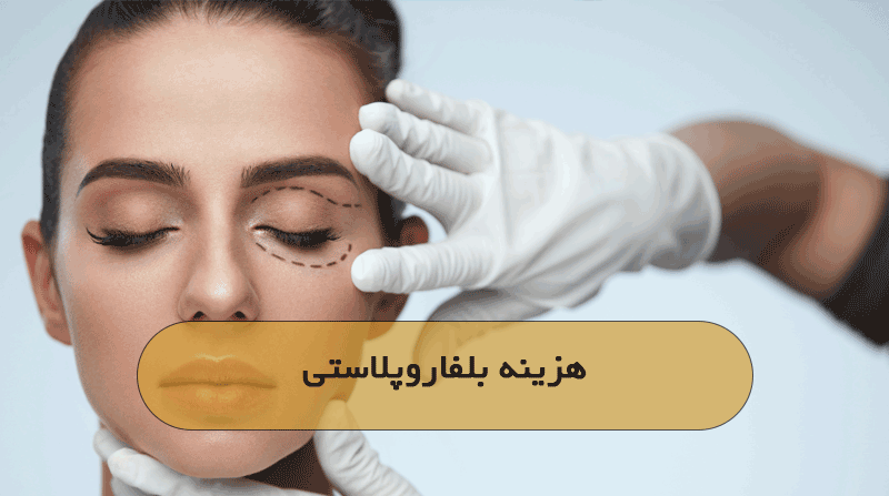 هزینه بلفاروپلاستی