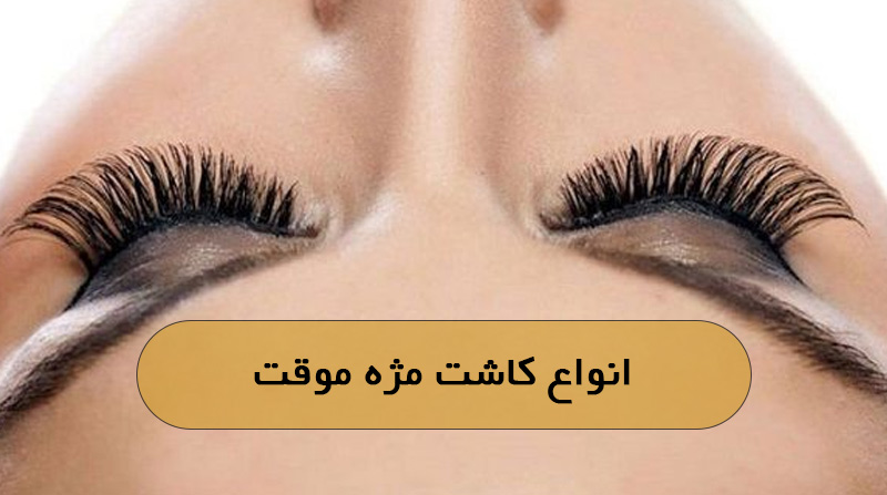 انواع کاشت مژه موقت