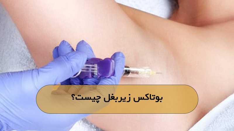 بوتاکس زیربغل چیست؟