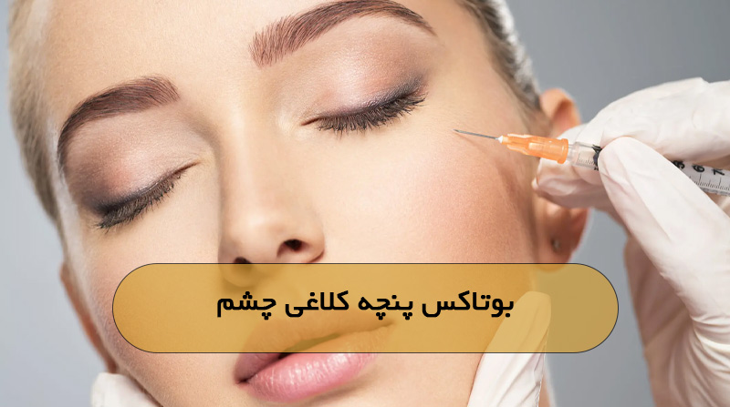 بوتاکس پنچه کلاغی چشم