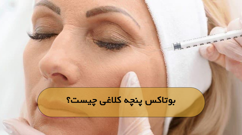 بوتاکس پنچه کلاغی چیست؟