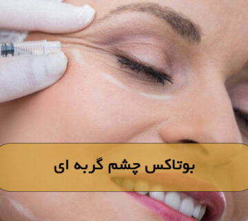 بوتاکس چشم گربه‌ای