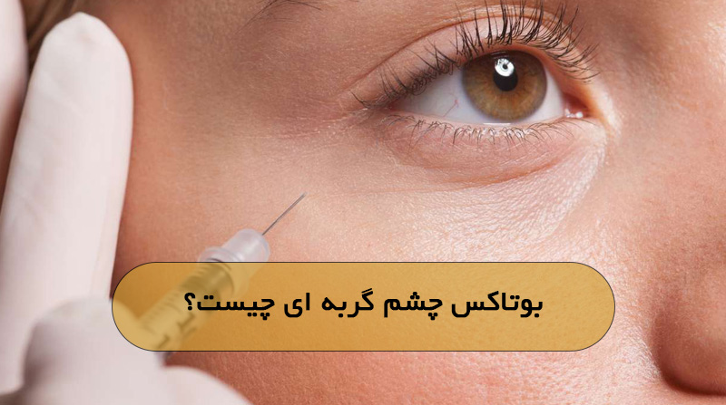 بوتاکس چشم گربه ای چیست؟