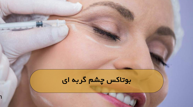 بوتاکس چشم گربه‌ای