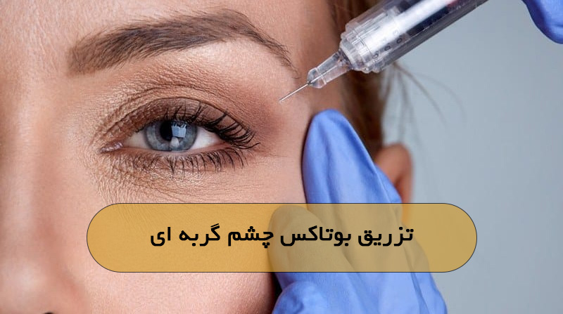 تزریق بوتاکس چشم گربه ای