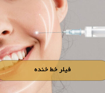 فیلر خط خنده 