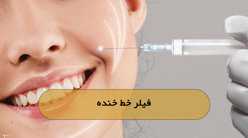 فیلر خط خنده 