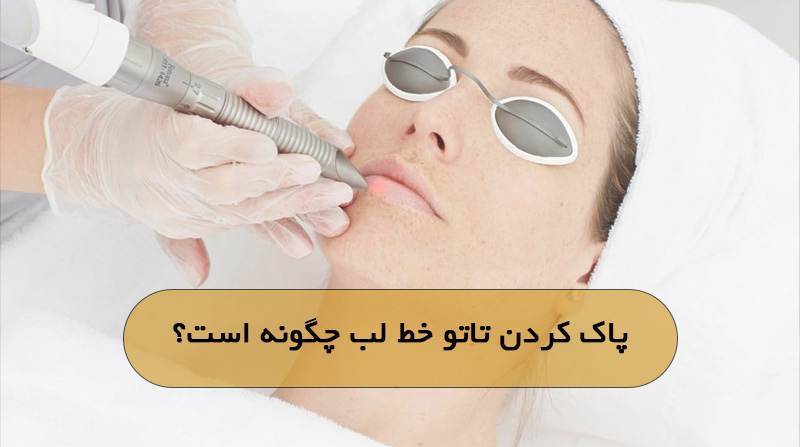 قیمت پاک کردن تاتو خط لب چقدر است؟