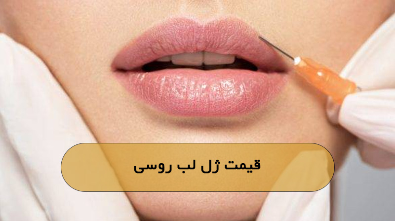 قیمت ژل لب روسی