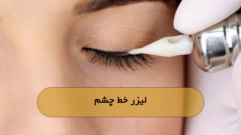 لیزر خط چشم