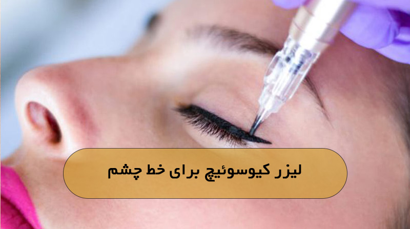 لیزر کیوسوئیچ برای خط چشم