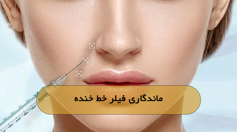 ماندگاری فیلر خط خنده