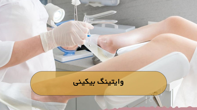 وایتینگ بیکینی