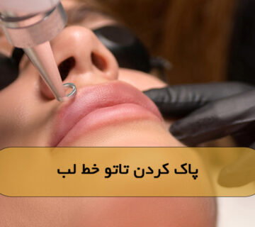 پاک کردن تاتو خط لب
