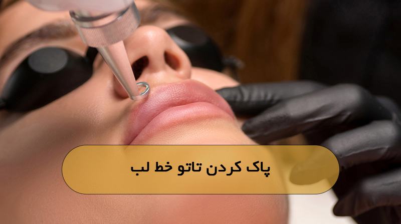 پاک کردن تاتو خط لب