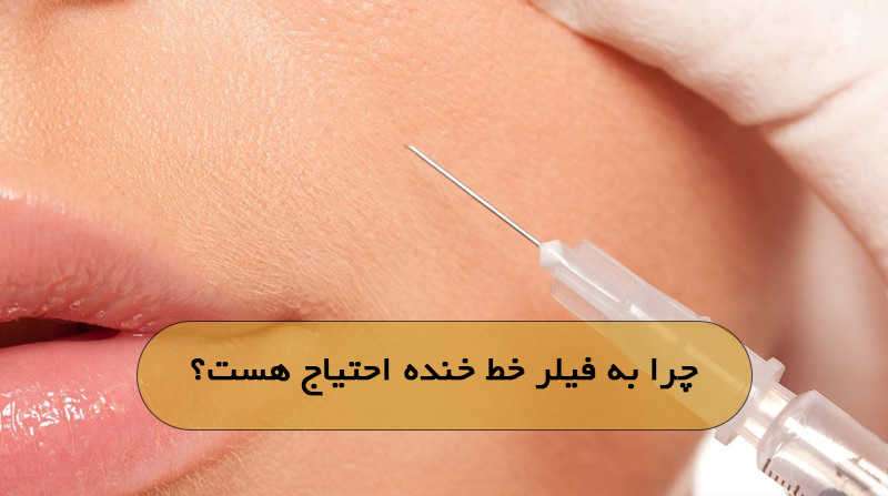 چرا به فیلر خط خنده احتیاج هست؟