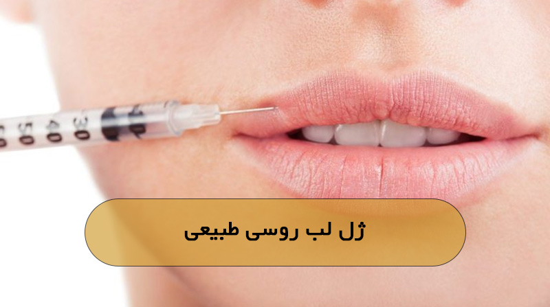 ژل لب روسی طبیعی