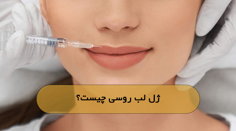 ژل لب روسی چیست؟