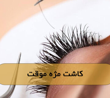 کاشت مژه موقت