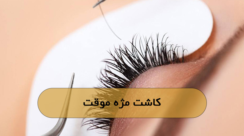 کاشت مژه موقت