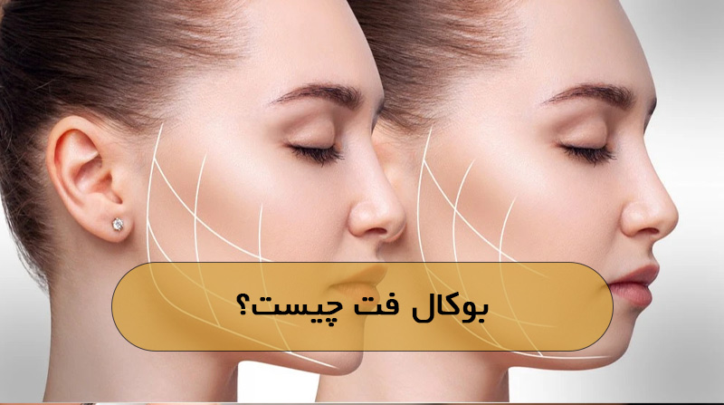 بوکال فت چیست؟