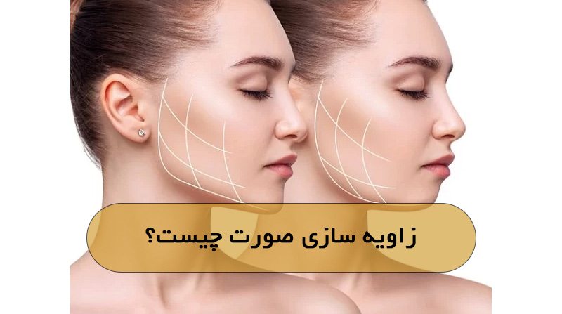 زاویه سازی صورت چیست؟