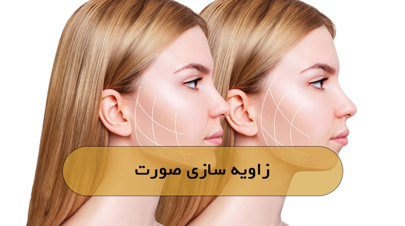 زاویه سازی صورت