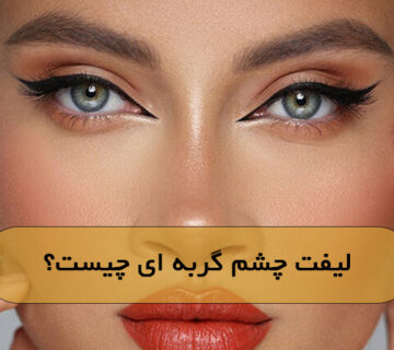 لیفت چشم گربه ای چیست؟