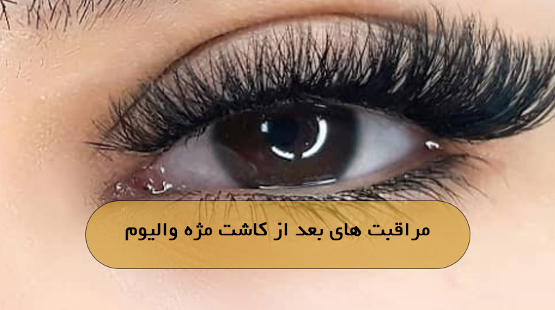 مراقبت های بعد از کاشت مژه والیوم